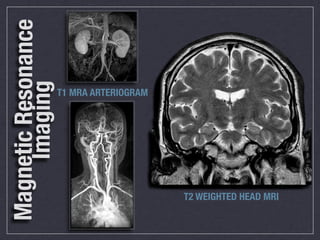 Magnetic Resonance
     Imaging
                     T1 MRA ARTERIOGRAM




                                          T2 WEIGHTED HEAD MRI
 