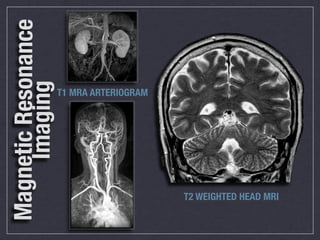 Magnetic Resonance
     Imaging
                     T1 MRA ARTERIOGRAM




                                          T2 WEIGHTED HEAD MRI
 