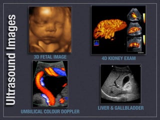 Ultrasound Images


                         3D FETAL IMAGE         4D KIDNEY EXAM




                                               LIVER & GALLBLADDER
                    UMBILICAL COLOUR DOPPLER
 