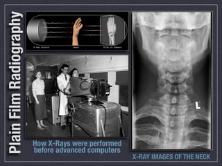 Plain Film Radiography




                         How X-Rays were performed
                         before advanced computers
                                                     X-RAY IMAGES OF THE NECK
 