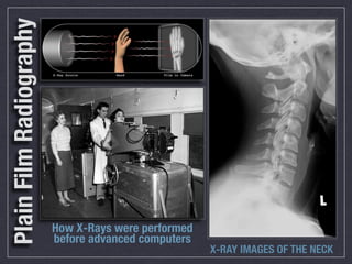 Plain Film Radiography




                         How X-Rays were performed
                         before advanced computers
                                                     X-RAY IMAGES OF THE NECK
 