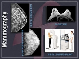 Mammography

PLAIN FILM MAMMOGRAM


                            DIGITAL MAMMOGRAM
                            BREAST MRI




DIGITAL MAMMOGRAPHY
 