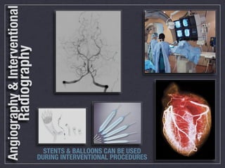 Angiography & Interventional
                 Radiography




                                 STENTS & BALLOONS CAN BE USED
                               DURING INTERVENTIONAL PROCEDURES
 