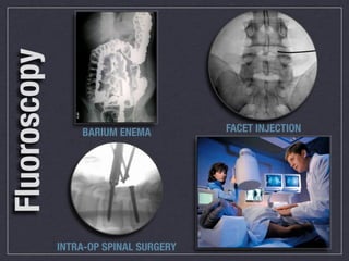Fluoroscopy

                  BARIUM ENEMA          FACET INJECTION




              INTRA-OP SPINAL SURGERY
 