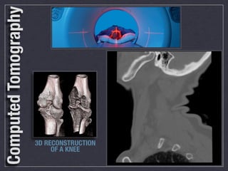 Computed Tomography
                               Develop your skills and expand your knowledge through a career path in:




                                                  We’re a dynamic team of medical professionals
                                                  working in an exciting downtown hospital in the heart

                                                  Join our team and you will be working in a fast-paced urban
                                                  health care environment that promotes job satisfaction,
                                                  continuing education and a commitment to providing the ﬁnest
                                                  imaging services available for superb patient care.
                                                  The medical Imaging team        We offer competitive packages
                                                  at St. Michael’s Hospital       along with comprehensive beneﬁts
                                                  provides the highest            including:

                                                  quality diagnostic services
                                                  to our patients. We are
                                                  an integral part of one of
                                                  Canada’s top teaching and
                                                  research hospitals, with
                                                  state of the art equipment, serving a diverse inner city patient
                                                  population.



                      3D RECONSTRUCTION
                           OF A KNEE
 