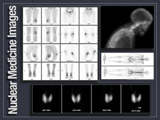 Nuclear Medicine Images

              Images...
 