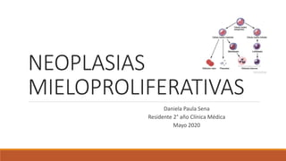 NEOPLASIAS
MIELOPROLIFERATIVAS
Daniela Paula Sena
Residente 2° año Clínica Médica
Mayo 2020
 