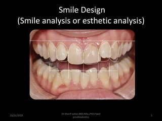 Smile Design
(Smile analysis or esthetic analysis)
10/21/2019
Dr.Sherif sultan,BDS,MSc,PhD,Fixed
prosthodontics
1
 