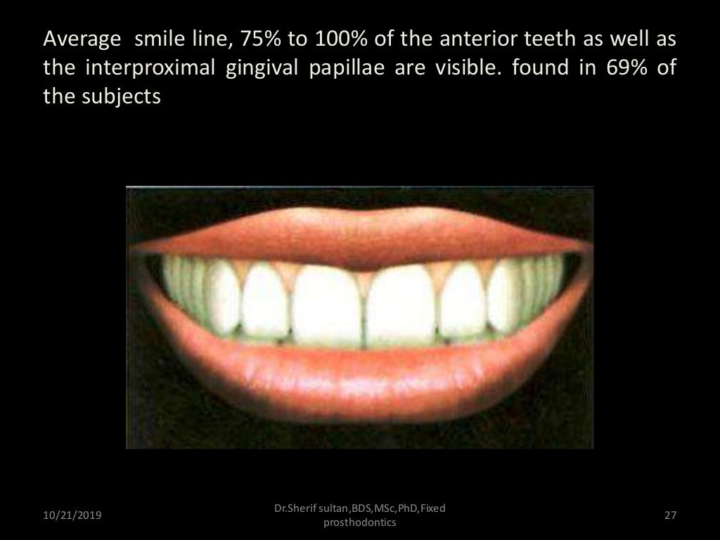 Smile analysis and digital smile design