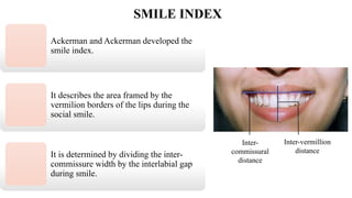 Comprehensive Smile Analysis: Anatomy, Classification, and Aesthetics ...