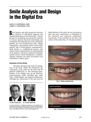 Smile Analysis and Design
in the Digital Era
MARC B. ACKERMAN, DMD
JAMES L. ACKERMAN, DDS




S   mile analysis and smile design have become
    key elements of orthodontic diagnosis and
treatment planning over the last decade.1-3 Recent
                                                                                 lateral borders of the smile, the eye can perceive
                                                                                 inner and outer commissures, as delineated by
                                                                                 the innermost and outermost confluences,
advances in technology now permit the clinician                                  respectively, of the vermillion of the lips at the
to measure dynamic lip-tooth relationships and                                   corners of the mouth (Fig. 2). The inner commis-
incorporate that information into the orthodontic
problem list and biomechanical plan. Digital
videography is particularly useful in both smile
analysis and in doctor/patient communication.
Smile design is a multifactorial process, with
clinical success determined by an understanding
of the patient’s soft-tissue treatment limitations                                                    Display Zone
and the extent to which orthodontics or multidis-
ciplinary treatment can satisfy the patient’s and
orthodontist’s esthetic goals.

Anatomy of the Smile
      The upper and lower lips frame the display
zone of the smile. Within this framework, the                                     Gingival
                                                                                  Scaffold
components of the smile are the teeth and the
gingival scaffold (Fig. 1). The soft-tissue deter-                                Teeth                                       Lips
minants of the display zone are lip thickness,
intercommissure width, interlabial gap, smile
index (width/height), and gingival architecture.
Although the commissures of the lips form the
                                                                                                Fig. 1 Smile components.


                                                                                   Outer Commissure




Dr. Marc Ackerman            Dr. James Ackerman

Dr. Marc Ackerman is a Research Associate in the Department of
Orthodontics, University of North Carolina at Chapel Hill. Both authors            Inner Commissure
are in the private practice of orthodontics at 931 E. Haverford Road,
Suite 2, Bryn Mawr, PA 19010; e-mail: ackersmile@aol.com.                                    Fig. 2 Anatomy of commissures.




VOLUME XXXVI NUMBER 4                                               © 2002 JCO, Inc.                                           221
 