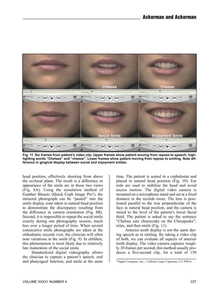 Smile analysis digital era | PDF