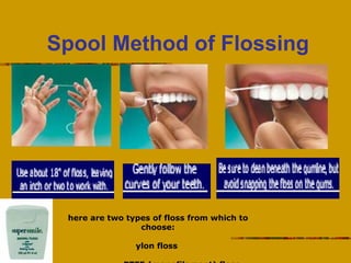 Spool Method of Flossing There are two types of floss from which to choose: Nylon floss  PTFE (monofilament) floss USED IN...