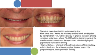 smile design | PPTX
