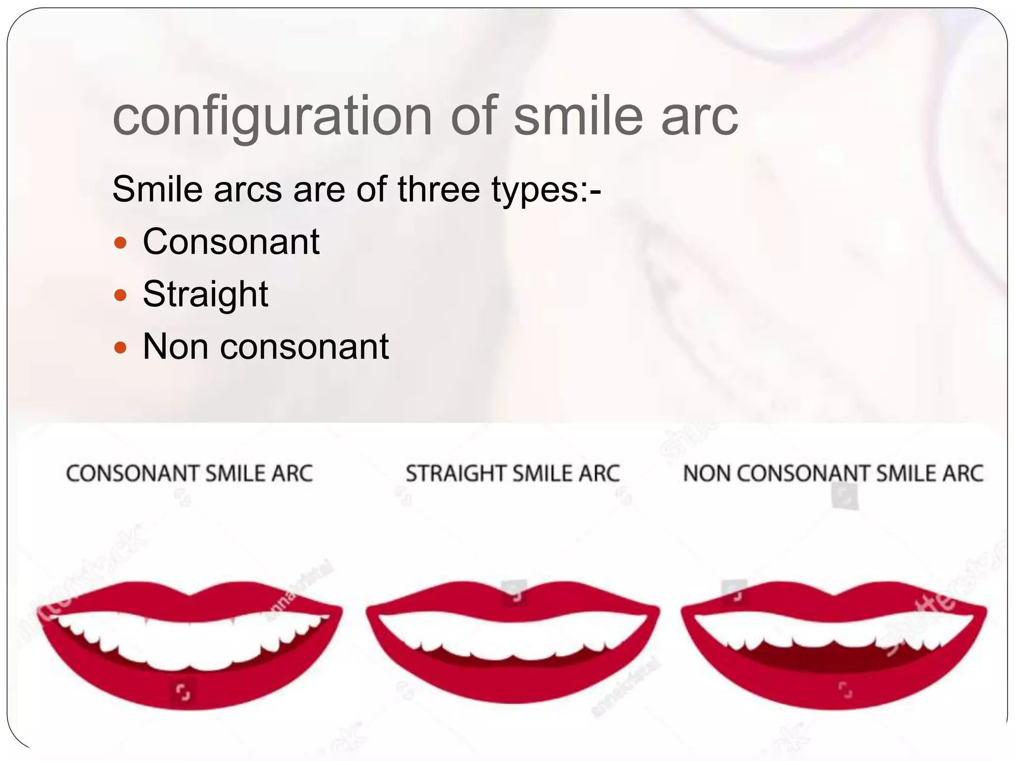 Smile design in orthodontics.pptx