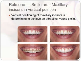 Smiling Position Smile design in orthodontics.pptx