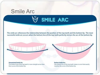 Smile Design Recession Smile design in orthodontics.pptx