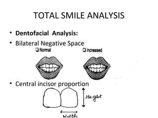 TOTAL SMILE ANALYSIS
• Dentofacial Analysis:
• Bilateral Negative Space
• Central incisor proportion
 