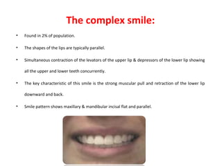 The complex smile:
• Found in 2% of population.
• The shapes of the lips are typically parallel.
• Simultaneous contraction of the levators of the upper lip & depressors of the lower lip showing
all the upper and lower teeth concurrently.
• The key characteristic of this smile is the strong muscular pull and retraction of the lower lip
downward and back.
• Smile pattern shows maxillary & mandibular incisal flat and parallel.
 