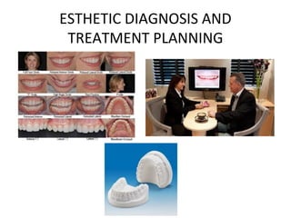 ESTHETIC DIAGNOSIS AND
TREATMENT PLANNING
 