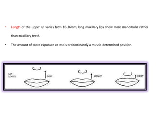 • Length of the upper lip varies from 10-36mm, long maxillary lips show more mandibular rather
than maxillary teeth.
• The amount of tooth exposure at rest is predominantly a muscle-determined position.
 