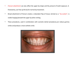 • Frenum attachment can also affect the upper-lip shape and the amount of tooth exposure. A
frenectomy, can free up the lip for normal lip movement.
• Broad attachment of frenum creates a redundant flap of tissue, termed as a ‘‘lip curtain’’, is
visible hanging beneath the upper lip when smiling.
• These procedures, used in combination with cosmetic dental procedures,can reduce gummy
smiles and produce a more esthetic smile.
 
