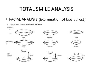 TOTAL SMILE ANALYSIS
• FACIAL ANALYSIS (Examination of Lips at rest)
 