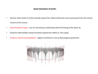 Axial inclination of teeth:
• Anterior teeth tends to incline mesially toward the midline & become more pronounced from the central
incisors to the canines.
• Overall esthetic impact - one of a harmonious relationship with the framing of the lower lip.
• Posterior teeth exhibits mesial inclination toward the midline as the cuspid.
• Creates a natural visual gradation - appear to diminish in size as they progress posteriorly.
 