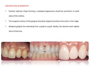 ARCHITECTURE & SYMMETRY:
• Positive radicular shape forming a scalloped appearance should be symmetric on both
sides of the midline.
• The marginal contour of the gingival should be sloped coronally to the end in a thin edge.
• Marginal gingival line extending from cuspid to cuspid. Ideally, the laterals reach slightly
short of that line.
 