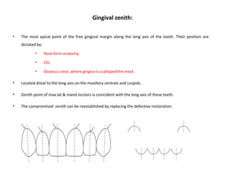 Gingival zenith:
• The most apical point of the free gingival margin along the long axis of the tooth. Their position are
dictated by:
• Root form anatomy.
• CEJ.
• Osseous crest, where gingiva is scalloped the most.
• Located distal to the long axis on the maxillary centrals and cuspids.
• Zenith point of max.lat & mand.incisors is coincident with the long axis of these teeth.
• The compromised zenith can be reestablished by replacing the defective restoration.
 