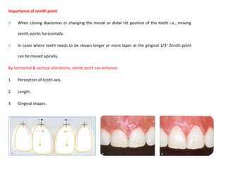 Importance of zenith point
o When closing diastemas or changing the mesial or distal tilt position of the tooth i.e., moving
zenith points horizontally.
o In cases where teeth needs to be shown longer or more taper at the gingival 1/3rd
Zenith point
can be moved apically.
By horizontal & vertical alterations, zenith point can enhance:
1. Perception of tooth axis.
2. Length.
3. Gingival shapes.
 