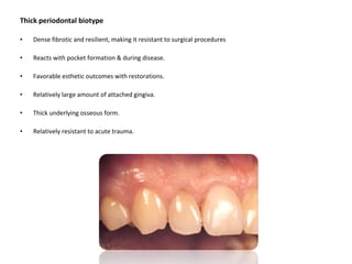 Thick periodontal biotype
• Dense fibrotic and resilient, making it resistant to surgical procedures
• Reacts with pocket formation & during disease.
• Favorable esthetic outcomes with restorations.
• Relatively large amount of attached gingiva.
• Thick underlying osseous form.
• Relatively resistant to acute trauma.
 