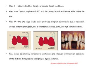 • Class II — observed in Class II angles or pseudo-Class II conditions.
• Class III — The GAL angle equals 90°, and the canine, lateral, and central all lie below the
GAL.
• Class IV —The GAL angle can be acute or obtuse. Gingival asymmetries due to recession,
altered patterns of eruption, loss of interdental papillae, clefts, and high frenal insertions.
• GAL should be relatively horizontal to the horizon and relatively symmetric on both sides
of the midline. It may radiate up slightly as it goes posterior.
Mclaren, inside dentistry—july/august 2009
 