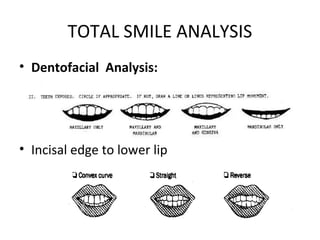 TOTAL SMILE ANALYSIS
• Dentofacial Analysis:
• Incisal edge to lower lip
 