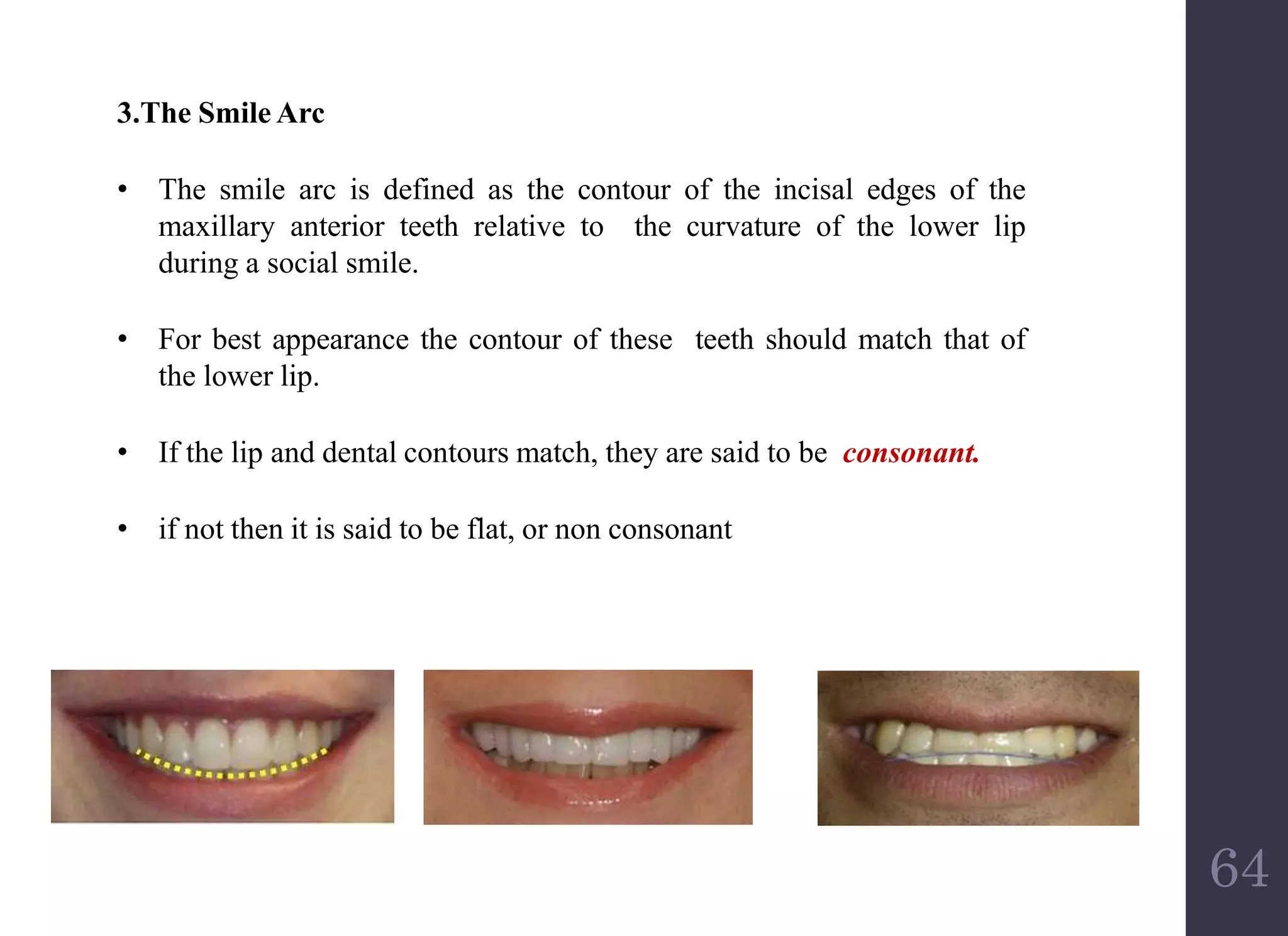 Smile esthetics in orthodontics | PPTX