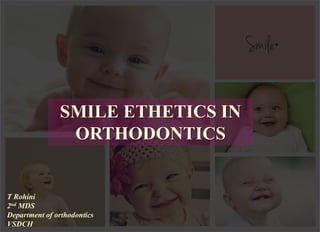SMILE ETHETICS IN
ORTHODONTICS
T Rohini
2nd MDS
Department of orthodontics
VSDCH
 