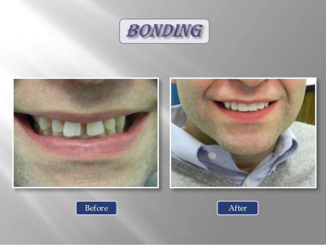 Smile gallery Cosmetic Dentistry Options at Pearl Dental