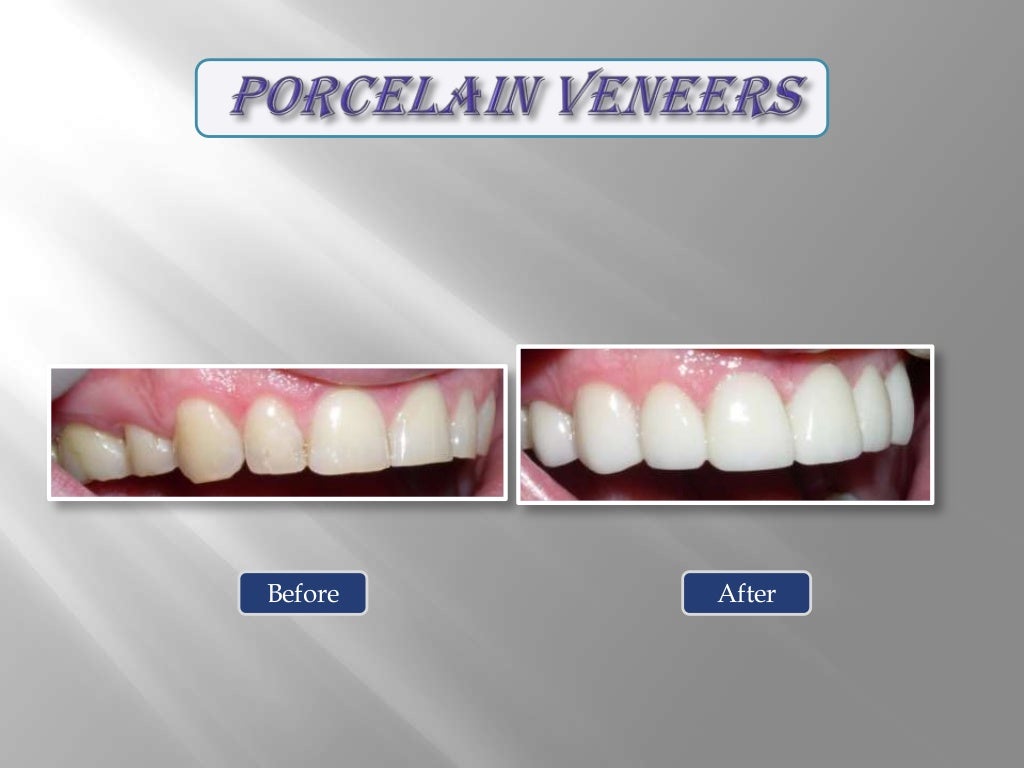 Smile gallery Cosmetic Dentistry Options at Pearl Dental