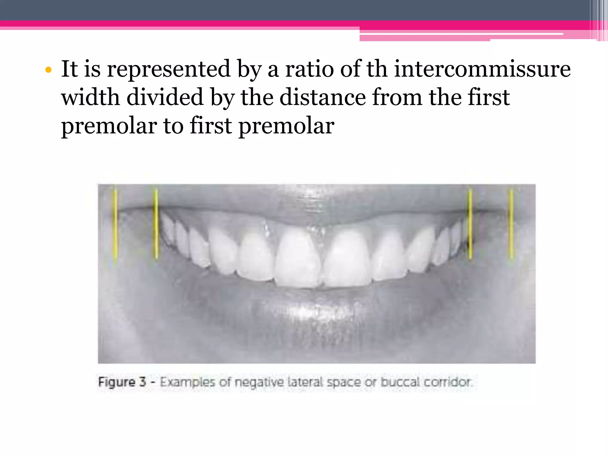 Smile in orthodontics | PPTX