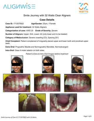 Smile Journey of Case ID 1712070922 with 32 Watts
Clear Aligners
Page 1 of 6
Smile Journey with 32 Watts Clear Aligners
Case Details
Case ID: 1712070922 Age/Gender: 20yrs. / Female
Appliance used for treatment: 32 Watts Aligners
Categorization of case: AWD 25 Grade of Severity: Severe
Number of Aligners: Upper- N/A, Lower- 22 (only lower arch to be treated)
Category of Malocclusion: Severe crowding (C3), Spacing (S1)
Chief Complaint: Patient complained of irregularly placed upper and lower tooth and proclined upper
teeth.
Extra Oral: Prognathic Maxilla and Normognathic Mandible, Normodivergent
Intra Oral: Class II molar relation on both sides.
Patient’s Extra & Intra Oral Images before treatment
 
