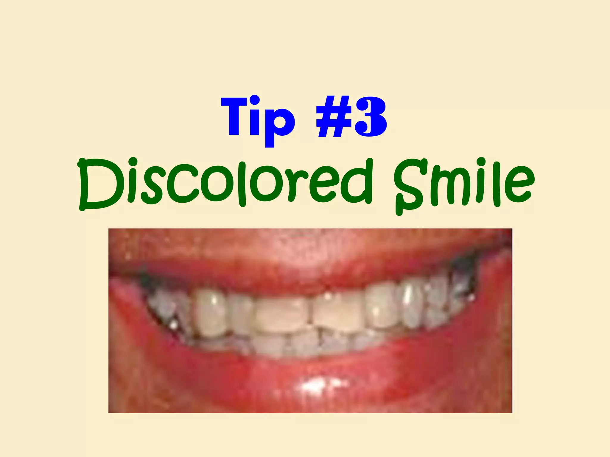 Tip #3
Discolored Smile

 