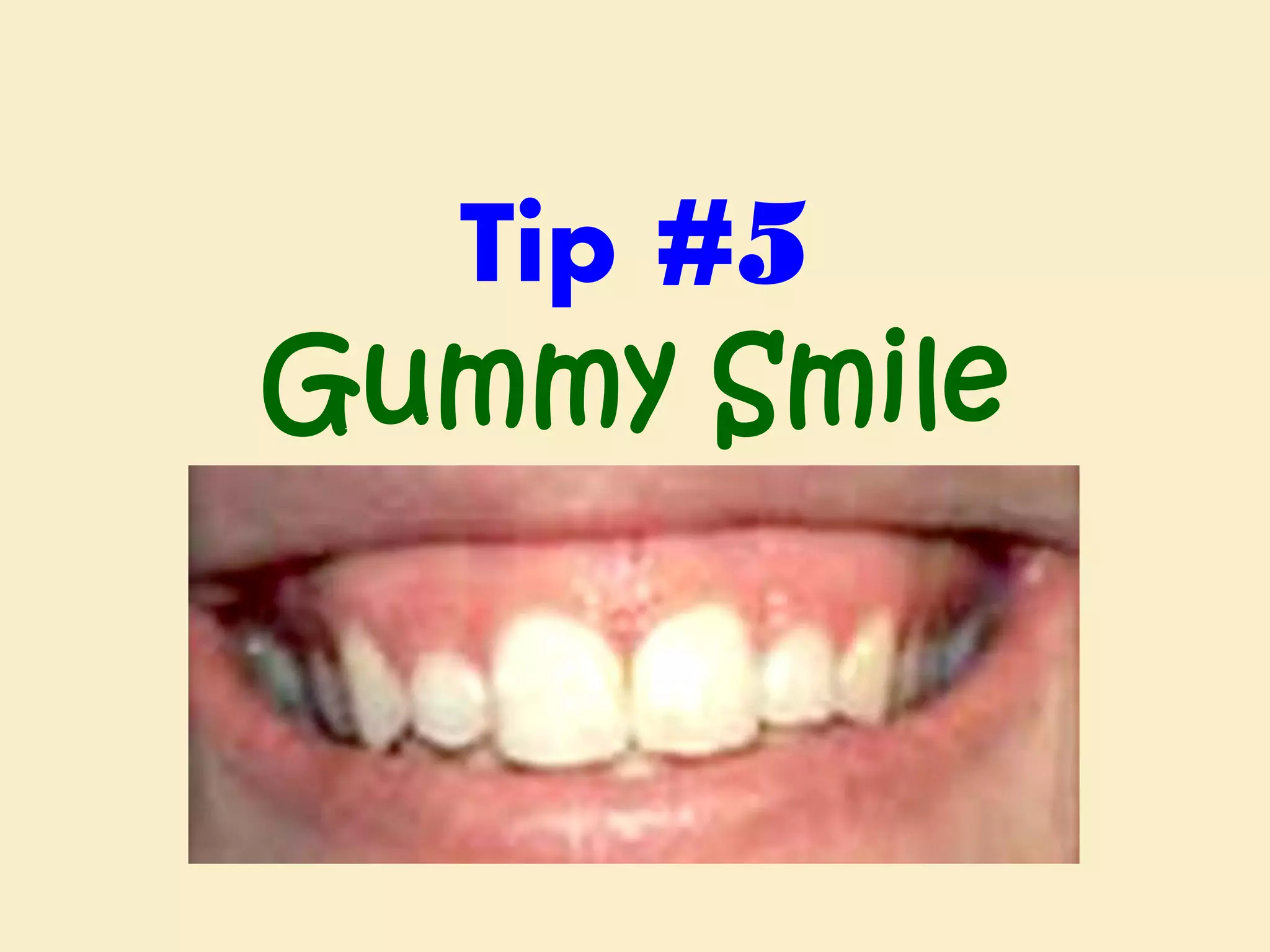Tip #5
Gummy Smile

 