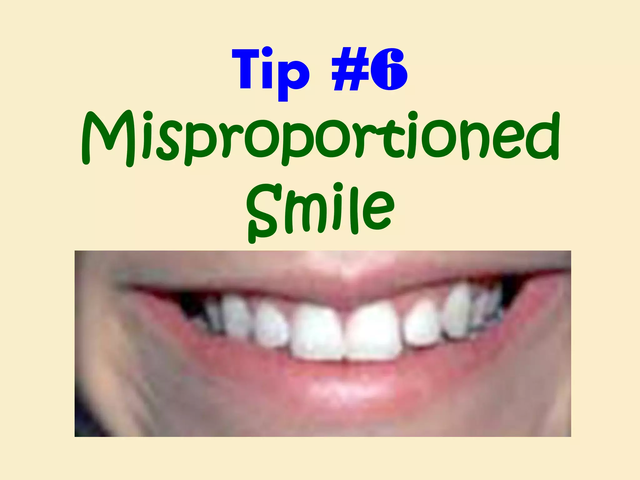 Tip #6
Misproportioned
Smile

 