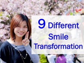 9 Different
Smile
Transformation

 