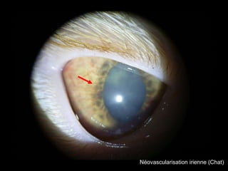 Néovascularisation irienne (Chat)

 