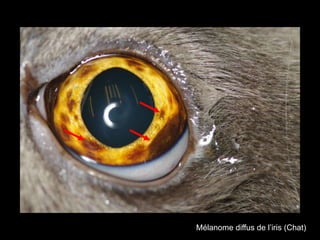 Mélanome diffus de l’iris (Chat)

 