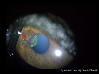 Kyste irien peu pigmenté (Chien)

 