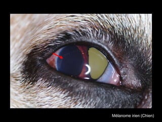 Mélanome irien (Chien)

 