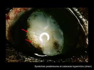 Synéchies postérieures et cataracte hypermûre (chien)

 