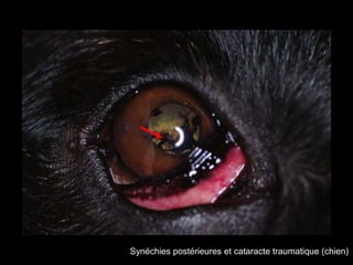 Synéchies postérieures et cataracte traumatique (chien)

 